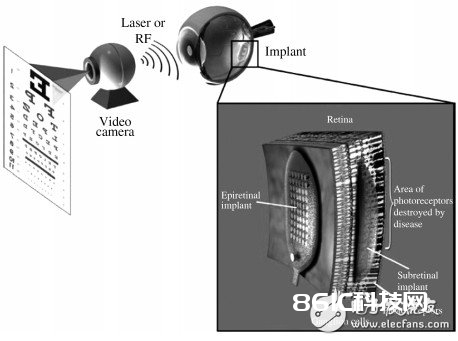 MEMS与IC集成工艺介绍 NEMS器材在%&&&&&% 中的运用